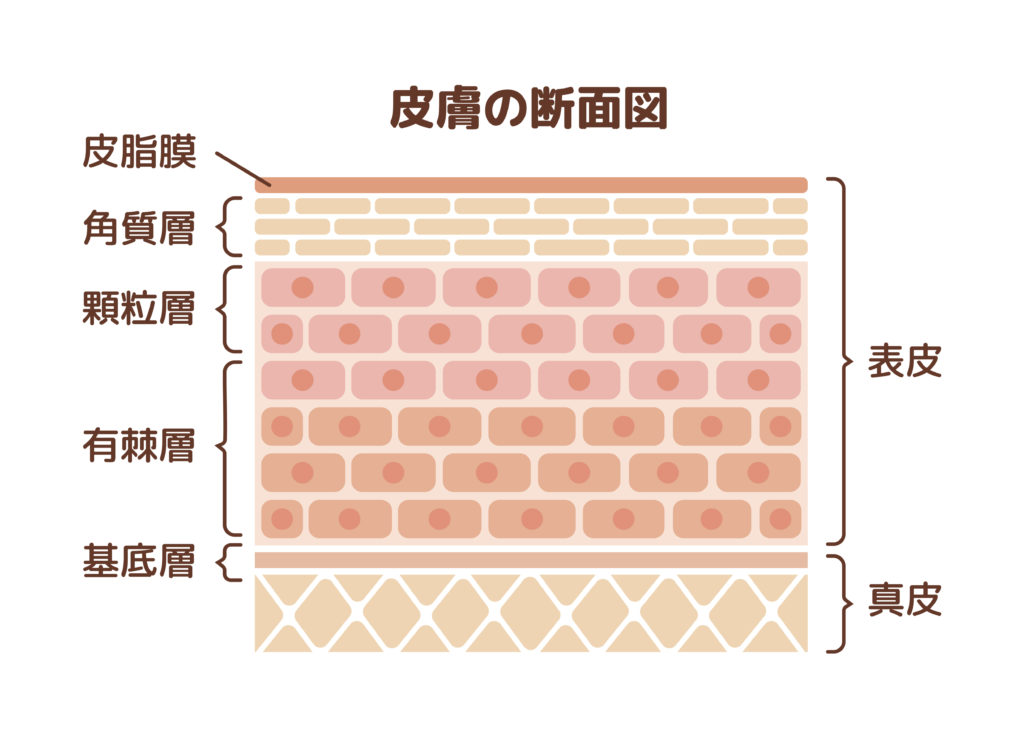 角質增厚