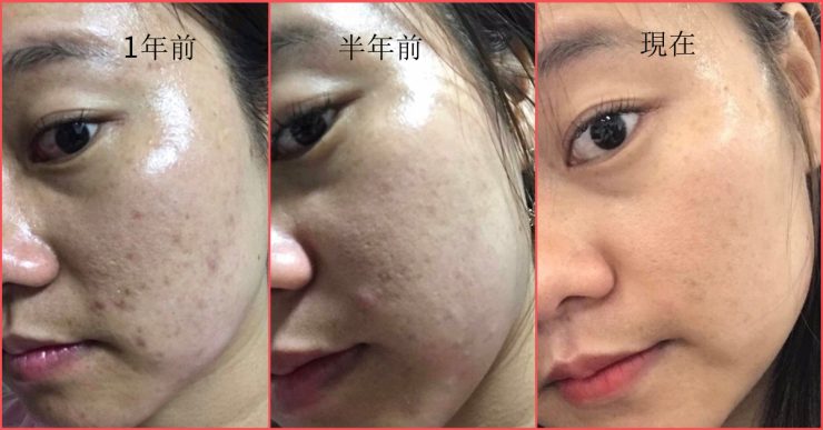 Sum37「青春奇蹟活酵肌秘露」的經驗分享
