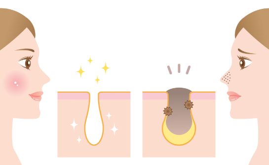 皮脂油垢不易累積在毛孔裡