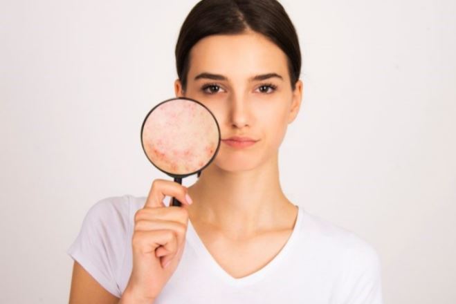 毛孔粗大保養品毛孔清潔Dr. Medion碳酸面膜