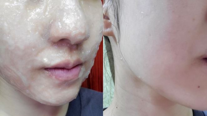 毛孔粗大保養品毛孔清潔Dr. Medion碳酸面膜