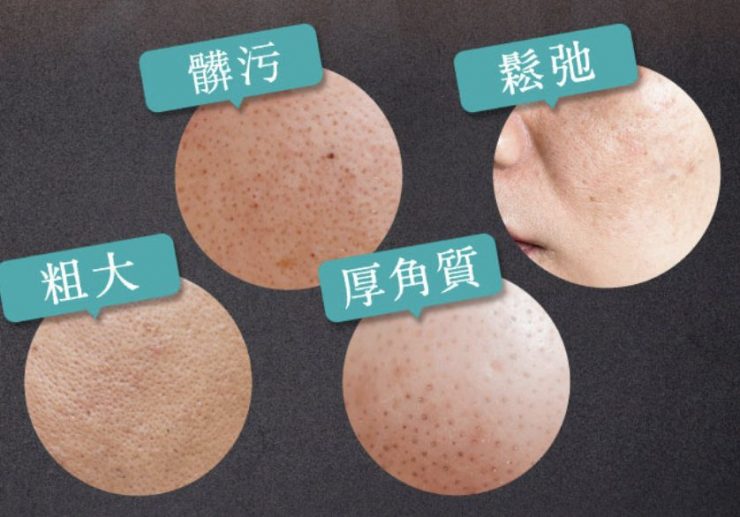 日本泡泡洗卸凝露推薦 卸妝凝露