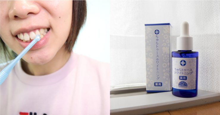 牙齒美白